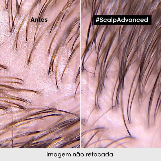 Serie Expert Scalp Shmp Purifier 1